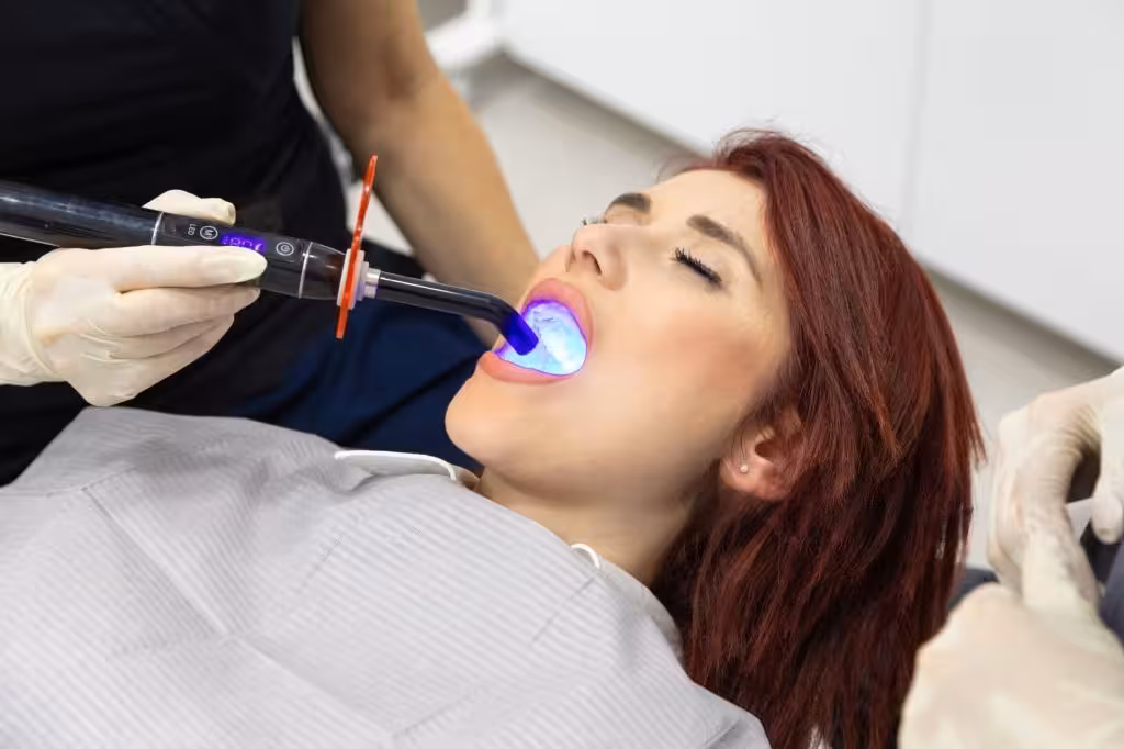 Dental Fillings at Smiling Molar Dental in Plainfield, NJ