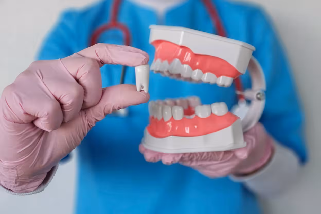 Permanent Teeth Replacement at Smiling Molar Dental in Plainfield, NJ